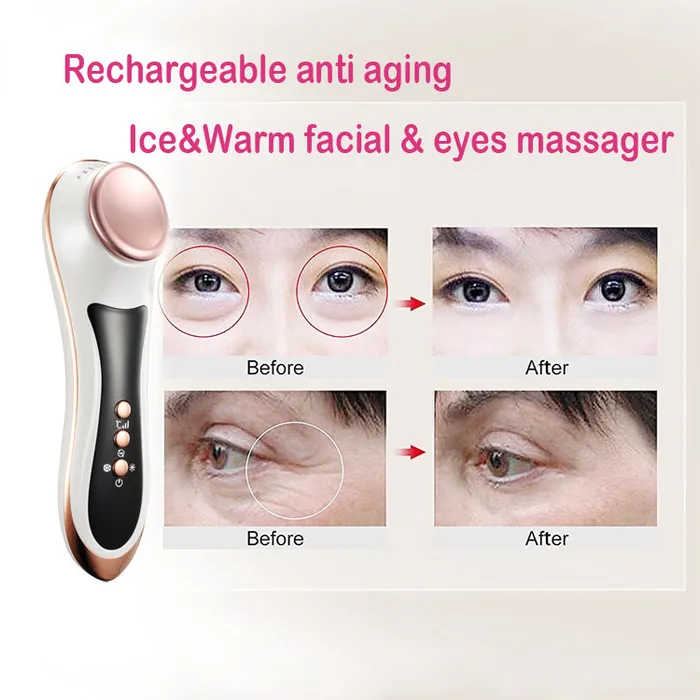 missammy Eye Care Cold Hot Massage Instrument RF Vibration Remove Wrinkle Beauty Device 887 Vibrators